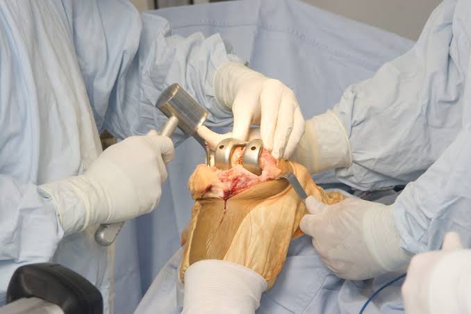 Orthopedic